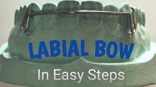 #labialbow #shortlabialbow How To Fabricate Labial Bow Step By Step||Labial Bow Demo