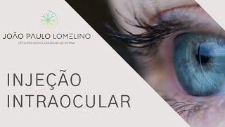 Injeção Intra Ocular com Dr João Paulo Lomelino