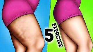 NO CELLULITE, NO DARK SPORTS, NO EXTRA FAT | JUST 5 SIMPLE EXERCISES TO FIX THIGHS