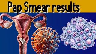Pap Smear Results Explained under 3 minutes