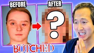 Plastic Surgeon Reacts to BOTCHED: Incredible Eye Reconstruction!