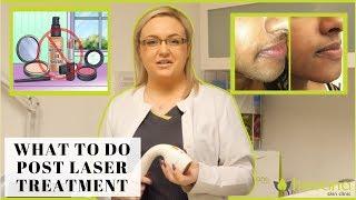 What To Do After Laser Hair Removal | Laser Hair Removal What To Expect