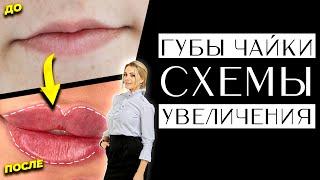 Губы - чайки СХЕМА увеличения