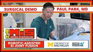 Robotic Assisted SI Joint Fusion - Paul Park, M.D.