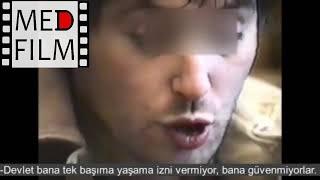 1. Mental retardation (Turkish) ©