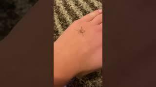 How to hold a brown recluse #spider #wtf