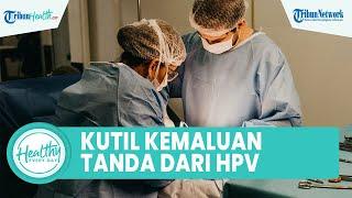 Hati-Hati! Munculnya Kutil pada Kemaluan Bisa Jadi Gejala HPV, Inilah Faktor Risiko untuk Tubuh