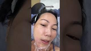 Hydro facial, spirulina, and warts off treatments