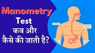 Manometry test कब और कैसे की जाती है ?  | What is Manometry Test | Dr. Zubin Dev Sharma  | Hindi