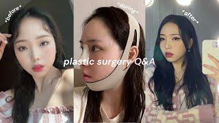 2 years after my plastic surgery in korea...︱SURGERY Q&A