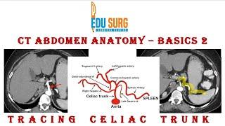 CT abdomen interpretation - celiac axis