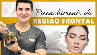 Harmonização Facial através do Preenchimento da Região Frontal com Ácido Hialurônico