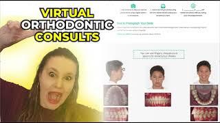 Virtual Orthodontic Consults