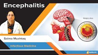 Encephalitis | Clinical Manifestations and Etiology Lecture on Infectious Medicine