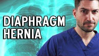 Diaphragm Hernia & What I Had To Do...