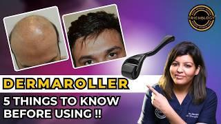 Dermaroller for Hairfall: Does It Work? | Hair Transplant Clinic  | Dadu Medical Centre