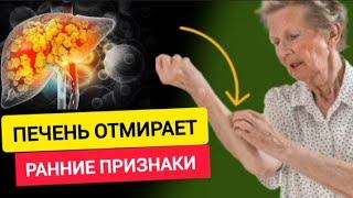 Вашей ПЕЧЕНИ Грозит Опасность: 10 ранних Признаков того, что ваша ПЕЧЕНЬ ОТМИРАЕТ