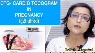 CTG  test प्रेगनेंसी में क्यों किया जाता है* CTG test IN PREGNANACY I in Hindi