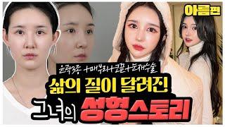 유튜버 아름, 성형 리얼 비포 에프터 (여캠 BJ들의 성형 이유)