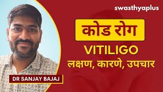 कोड रोगाबद्दलच्या मिथक | Vitiligo / White Patches: How to Treat? in Marathi | Dr Sanjay Bajaj