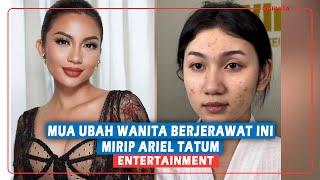 MUA Ubah Wanita Berjerawat Ini Mirip Ariel Tatum