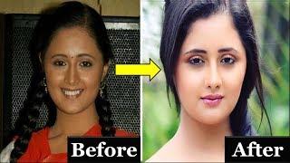 Top 10 Indian TV actresses with plastic surgery - The TopLists