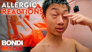 The Scariest Allergic Reactions on Bondi Rescue