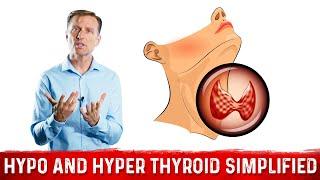 Hyperthyroid vs Hypothyroid Explained By Dr. Berg