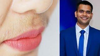 Facial Hair Treatment At Home | Facial Hair Removal Naturally | Dr Vivek Joshi