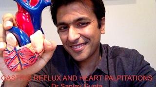 Gastric Reflux AND heart palpitations