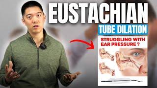 Eustachian Tube Balloon Dilation: How to Fix Ear Pressure & Fullness | ENT Doctor Explains