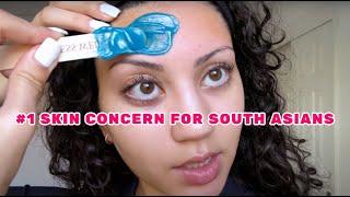 The Truth Behind Your 'Hyperpigmentation & Dullness'