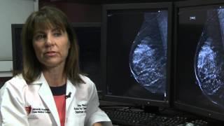 3D Mammography Finds Breast Cancer