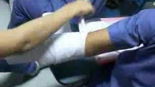 bandaging an arm