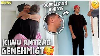 KIWU ANTRAG GENEHMIGT + Doppelkinn OP Update & Fazit | kobexmone