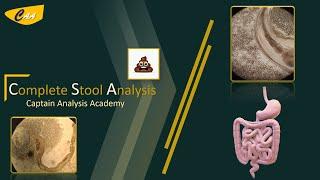 Complete Stool (Fecal) Analysis  تحليل البراز عملى