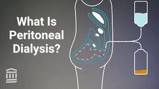 Peritoneal Dialysis: At Home Treatment for Kidney Failure | Mass General Brigham