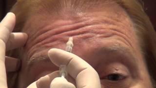 Botox Training - Forehead Injections - Empire Medical Training