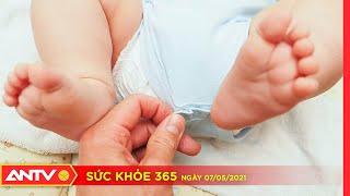 Những điều cần biết và cách xử trí hẹp bao quy đầu ở trẻ | Sức khỏe 365 | ANTV