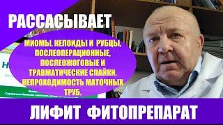 Лифит фитопрепарат. Рассасывает миомы, келоиды и рубцы, шрамы, спайки, послеоперационные и ожоговые.