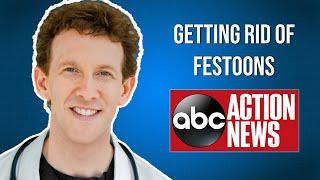 Dr. Adam Scheiner on ABC Action News: How to Get Rid of Festoons