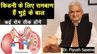 किडनी की सेहत ठीक करने का नेचुरल तरीका Natural Kidney Detox पांच जबरदस्त फायदे