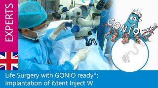 OCULUS GONIO ready® & iStent Inject w with Dr. Amit Pandey