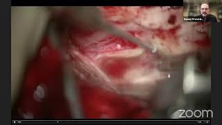 .Neurosurgical TV collaborates with EWNC for two days