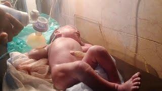 New born baby male came with difficulty in breath take action giving oxygen baby is fine thank u God