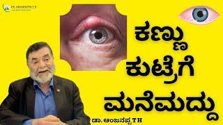 Home remedies for eye strain - Dr. Anjanappa TH
