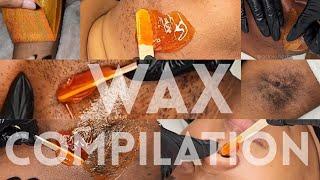 Waxing Marathon // Wax Compilation // Hirsutism // Leg // Underarm *20 MINUTES*