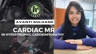 CARDIAC MR FOR HYPERTROPHIC CARDIOMYOPATHY | DR AVANTI GULHANE | DIAGNOSIS & PROGNOSIS | MRI HCM