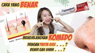 CARA AMPUH HILANGIN KOMEDO | PAKE PASTA GIGI?? BENER GAK SIH