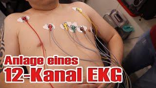 So klebst du ein 12-Kanal EKG! | EKG kleben